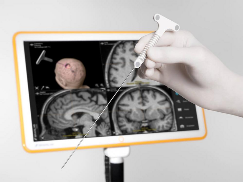 Auf Visite bei Brainlab »Der Arzt soll nicht Computer spielen